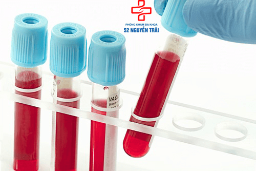xét nghiệm máu là gì