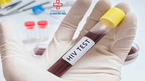 lợi ích của xét nghiệm hiv