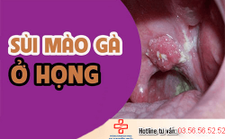 sui-mao-ga-o-hong