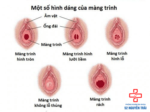 cấu tạo của màng trinh