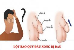 lot-bao-quy-dau-bi-dau