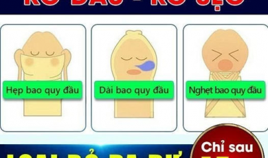 review-thu-thuat-cat-bao-quy-dau-tai-phong-kham-52-nguyen-trai